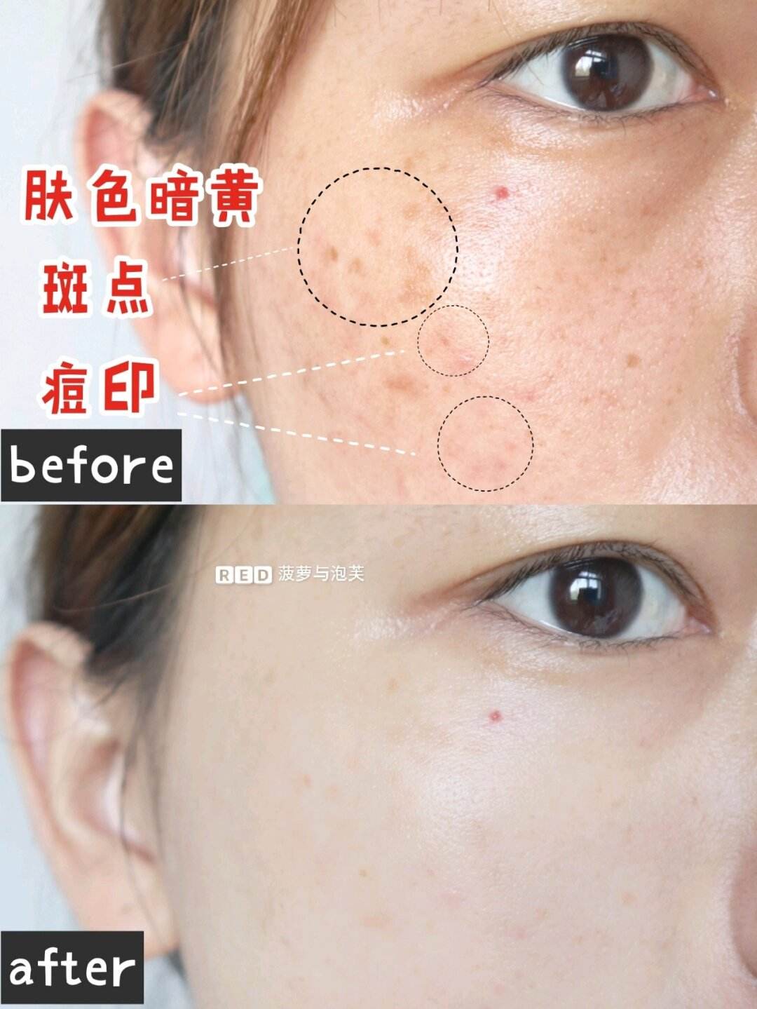 H.B(hbv是什么病毒?)